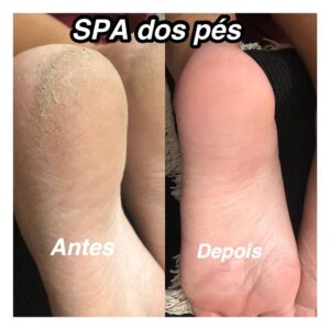 SPÁ DOS PÉS